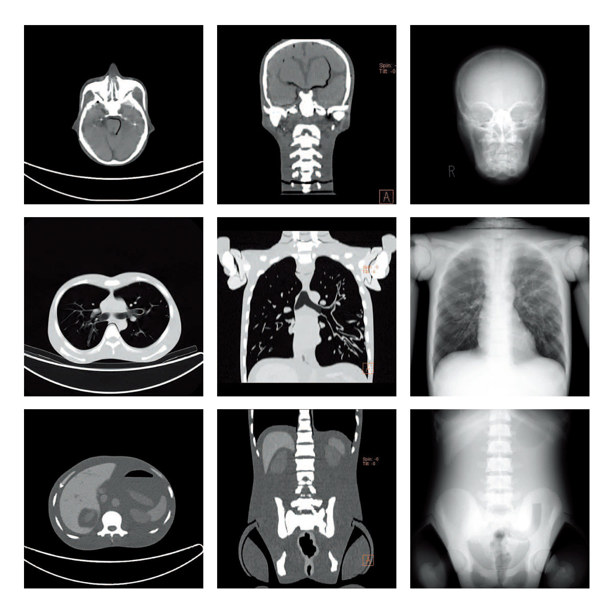全身模体 全身模体