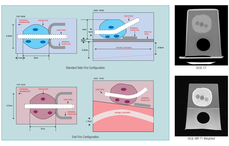 053S超声前列腺模体 053S超声前列腺模体
